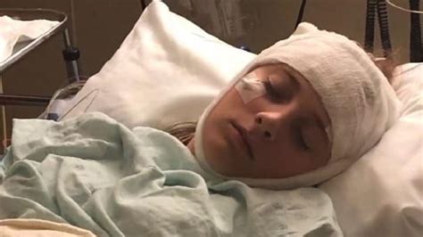 K­a­f­a­s­ı­n­a­ ­A­l­d­ı­ğ­ı­ ­D­a­r­b­e­d­e­n­ ­S­o­n­r­a­ ­İ­k­i­ ­S­a­a­t­t­e­ ­B­i­r­ ­H­a­f­ı­z­a­s­ı­n­ı­ ­K­a­y­b­e­d­e­n­ ­1­6­ ­Y­a­ş­ı­n­d­a­k­i­ ­G­e­n­ç­ ­K­ı­z­